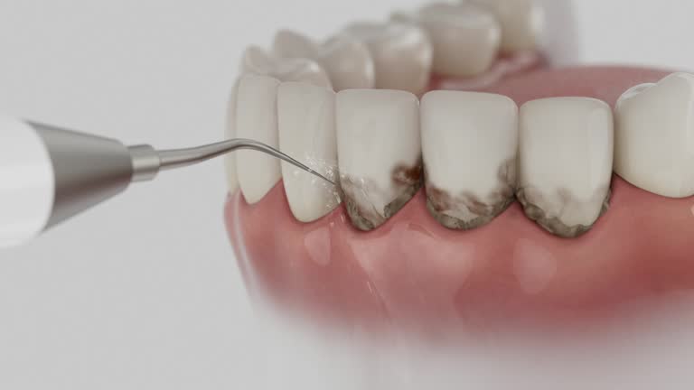 Trusted Teeth Whitening service in Town 'n' Country, FL - Dentist Open Now